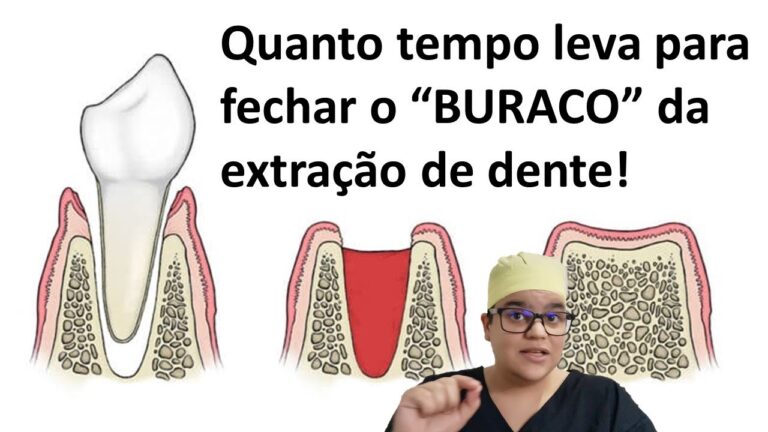 Descubra a Importância do Cheque Dentista Siso para a Saúde Bucal