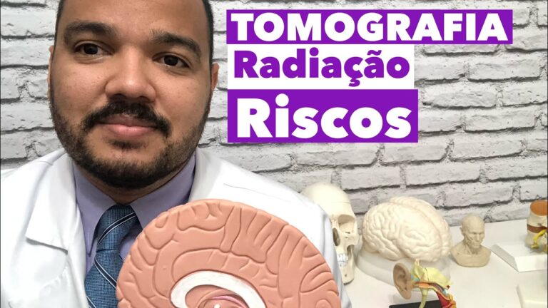 Maximizando Resultados: Descubra a Quantidade Ideal de TACs Anuais