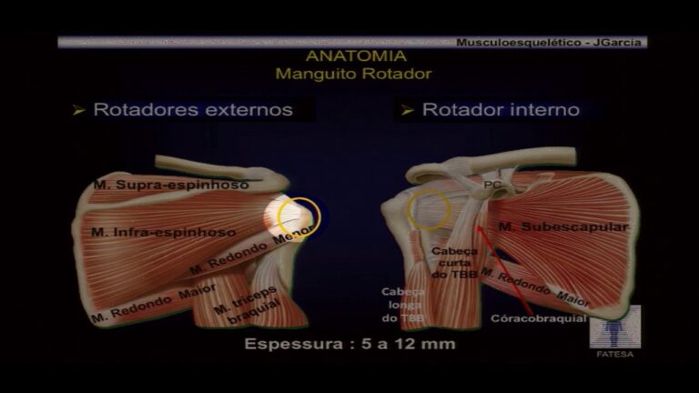 Osteoarticular Eco do Ombro: Diagnóstico e Tratamento