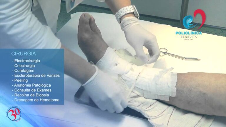 Servi&ccedil;os de Exames na Policlinica Benedita: Tudo que Voc&ecirc; Precisa Saber