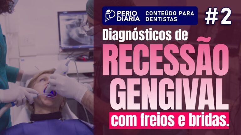 Excisão de Bridas Gengivais: Procedimento Otimizado