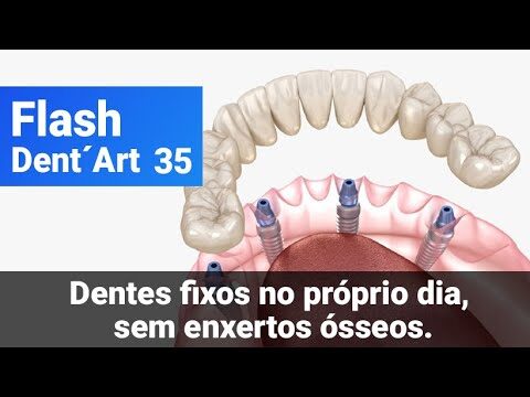 Arte Dental: O Novo Conceito de Beleza e Saúde Bucal